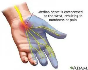hand_p1280045