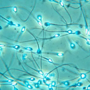 sperm