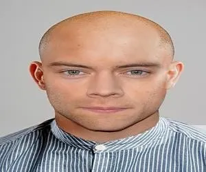 bald