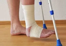 break leg